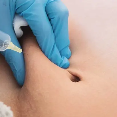 Aqualyx Fat Dissolving Injections (Body)