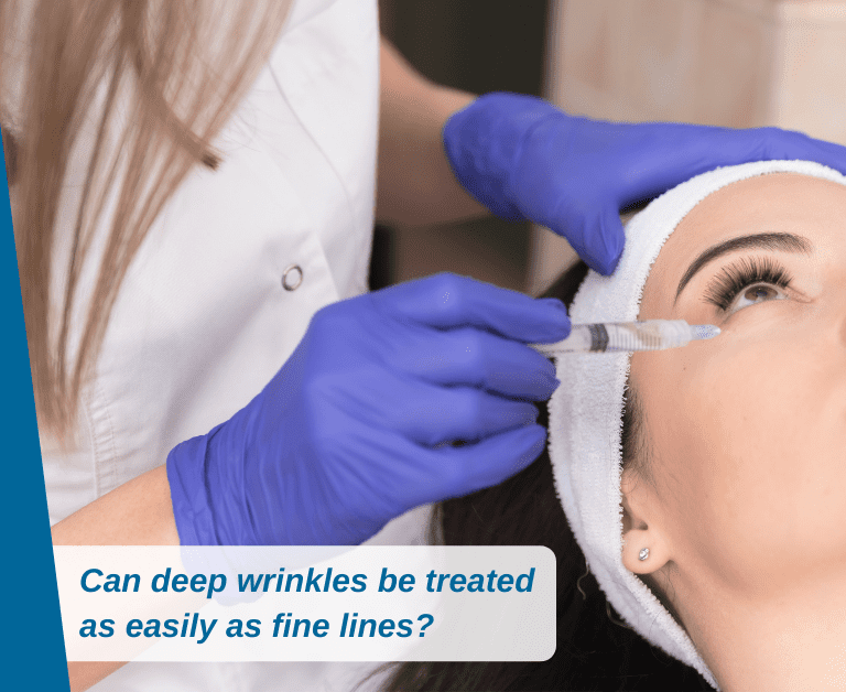 Can Deep Wrinkles Be Treated As Easily As Fine Lines On The Face?