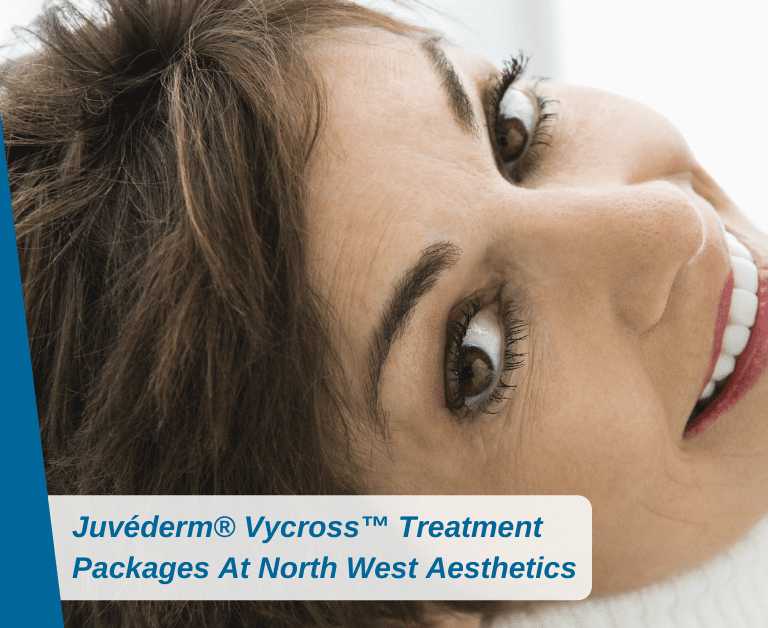 Juvéderm® Vycross™ Treatment Packages At North West Aesthetics