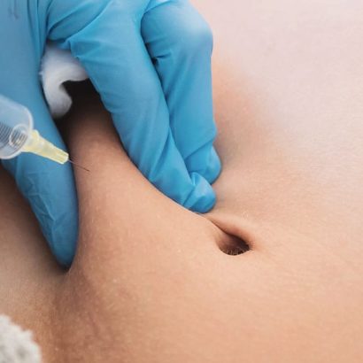 Aqualyx Fat Dissolving Injections (Body)