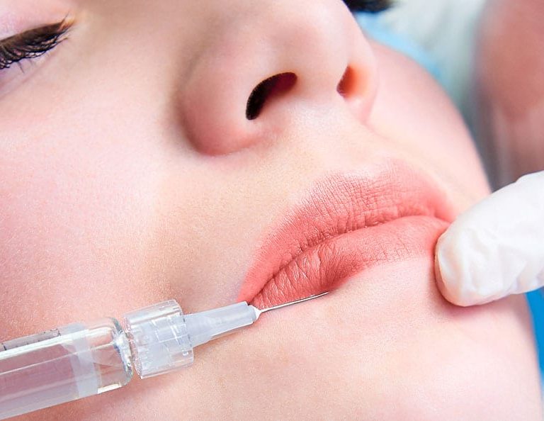 Lip Augmentation Course With Anaesthesia – North West Aesthetics