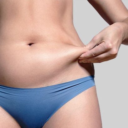 Excess Body Fat