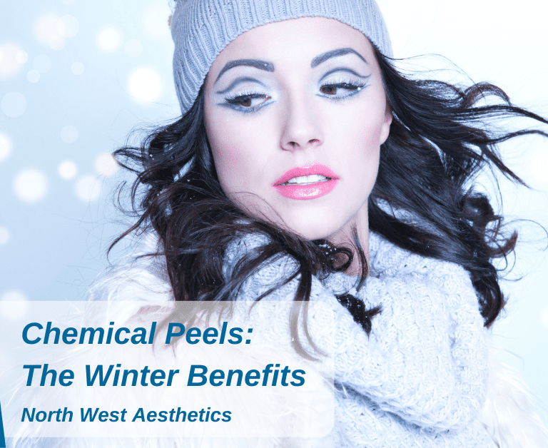 Chemical Peels: The Winter Benefits