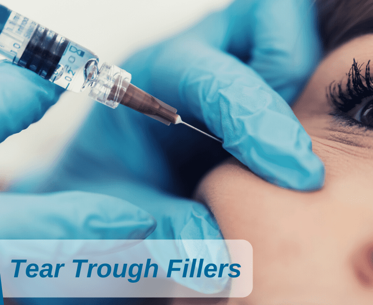 Tear Trough Fillers at North West Aesthetics