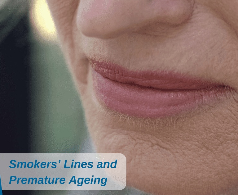 Smokers’ Lines and Premature Ageing: Make Your New Year’s Resolutions Now!