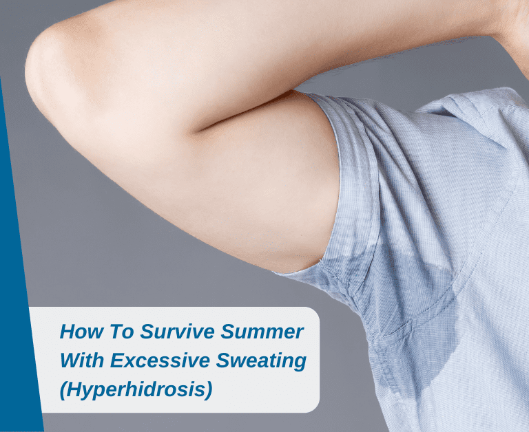How To Survive Summer With Excessive Sweating (Hyperhidrosis)