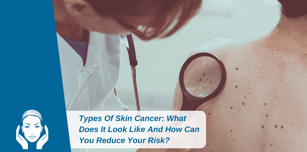 Types Of Skin Cancer: What Does It Look Like And How Can You Reduce Your Risk?