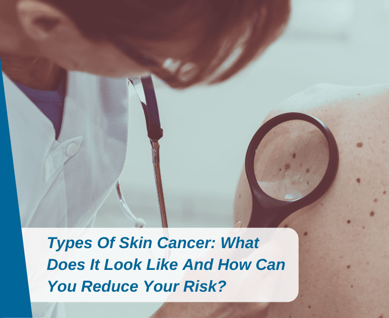 Types Of Skin Cancer: What Does It Look Like And How Can You Reduce Your Risk?
