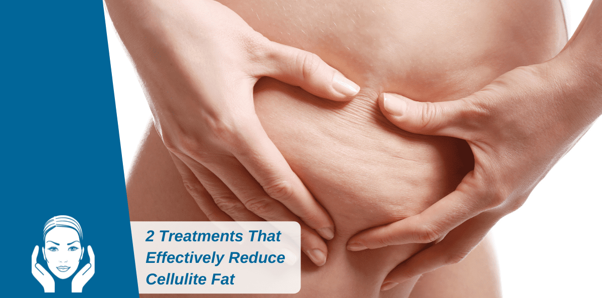 Wear Your Summer Wardrobe With Confidence: 2 Treatments That Effectively Reduce Cellulite Fat