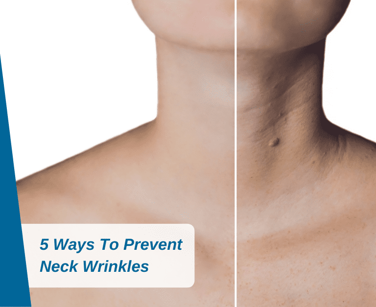 5 Ways To Prevent Neck Wrinkles 