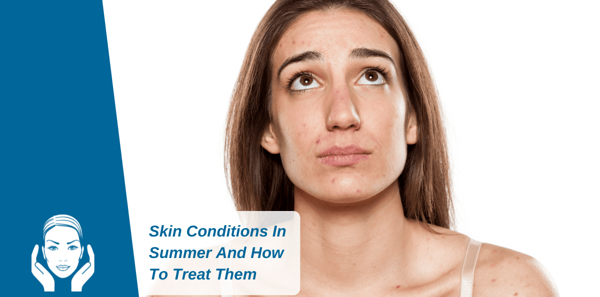 Skin Conditions In Summer And How To Treat Them