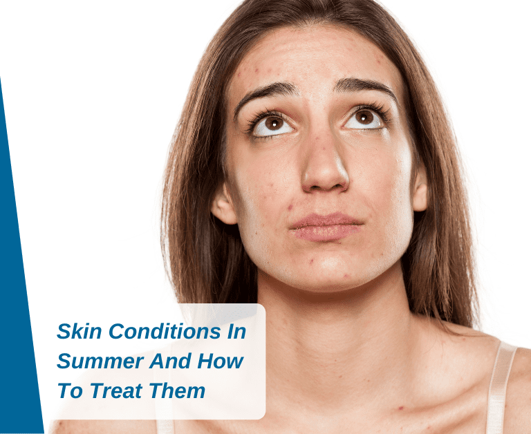 Skin Conditions In Summer And How To Treat Them