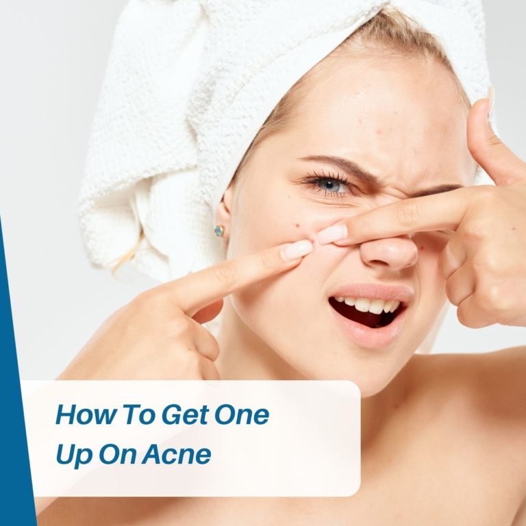 How To Get One Up On Acne