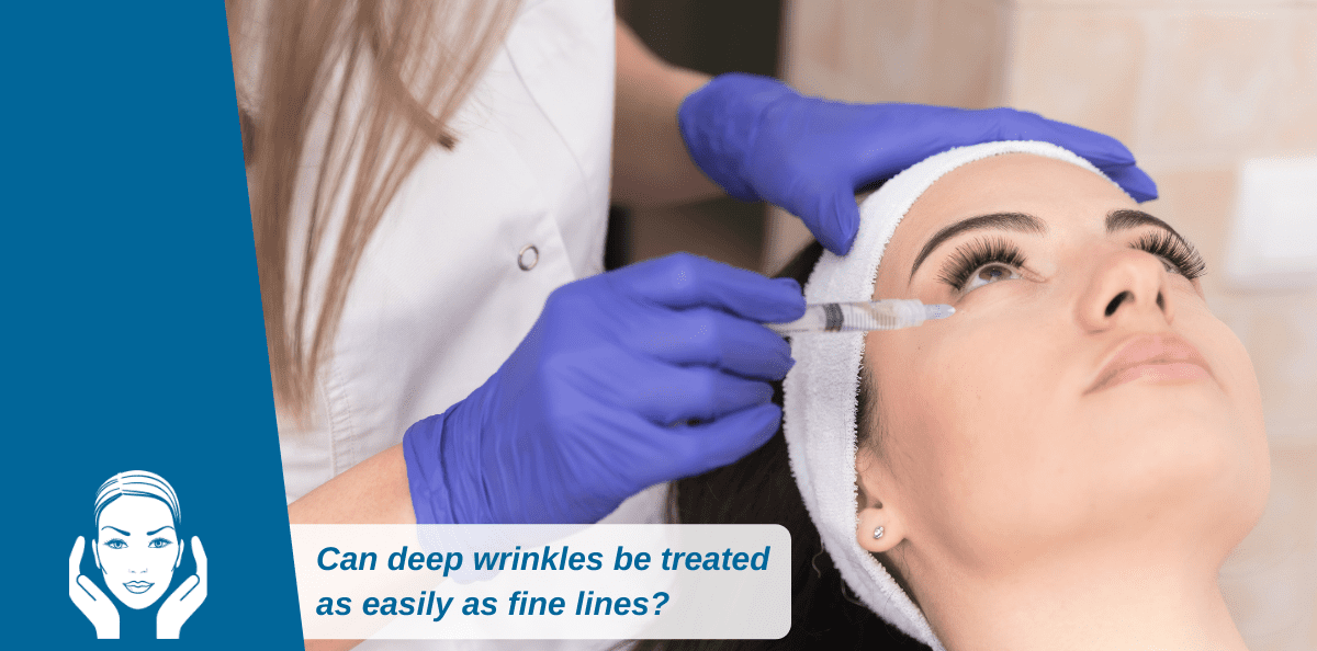 Can Deep Wrinkles Be Treated As Easily As Fine Lines On The Face?