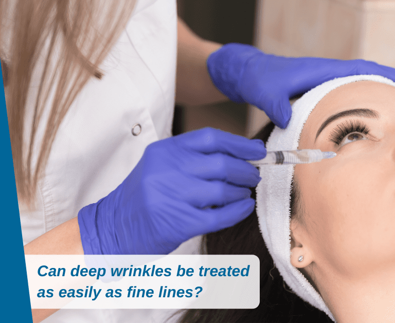 Can Deep Wrinkles Be Treated As Easily As Fine Lines On The Face?