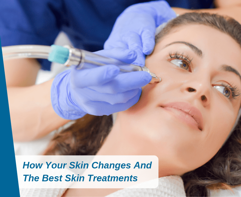 How Your Skin Changes And The Best Skin Treatments