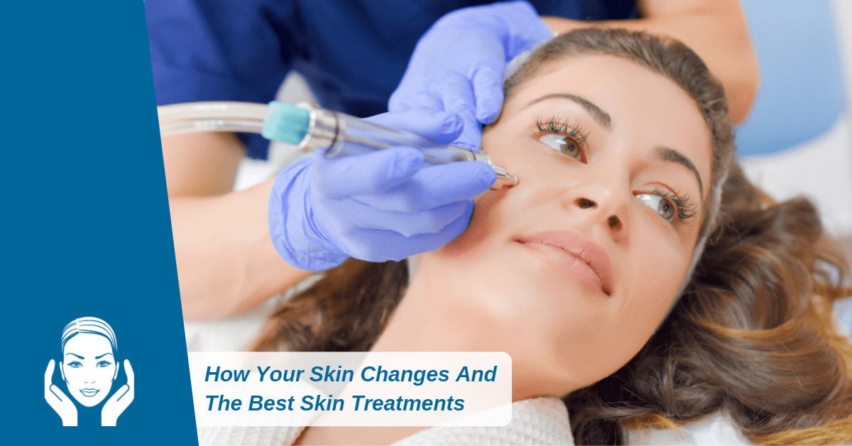 How to change skin. How to change skin
