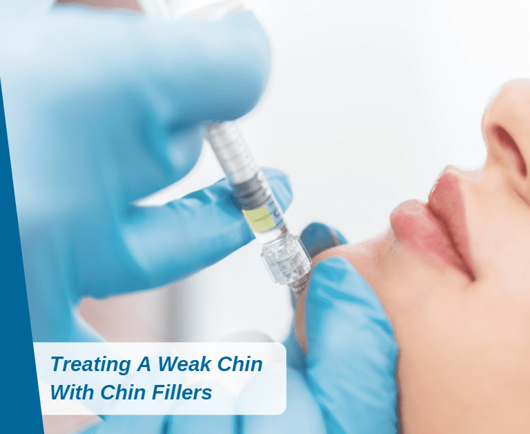 Treating A Weak Chin With Chin Fillers