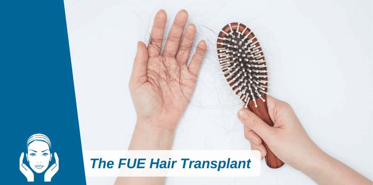 All You Need To Know About The FUE Hair Transplant