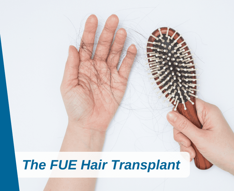 All You Need To Know About The FUE Hair Transplant