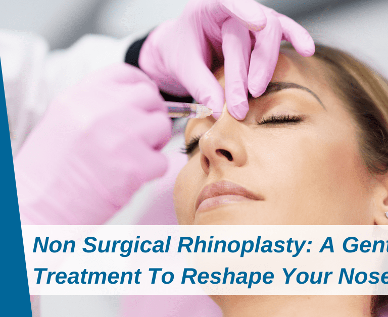 Non Surgical Rhinoplasty: A Gentler Treatment To Reshape Your Nose