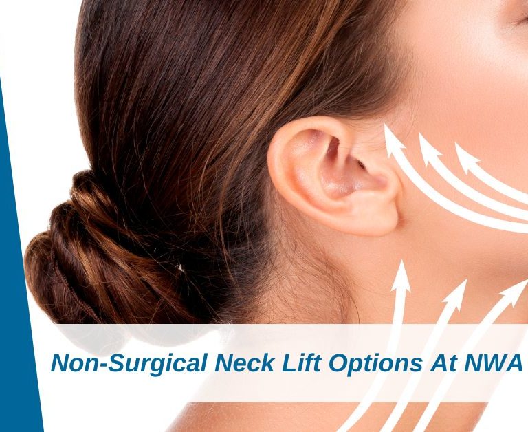 Non-Surgical Neck Lift Options At NWA