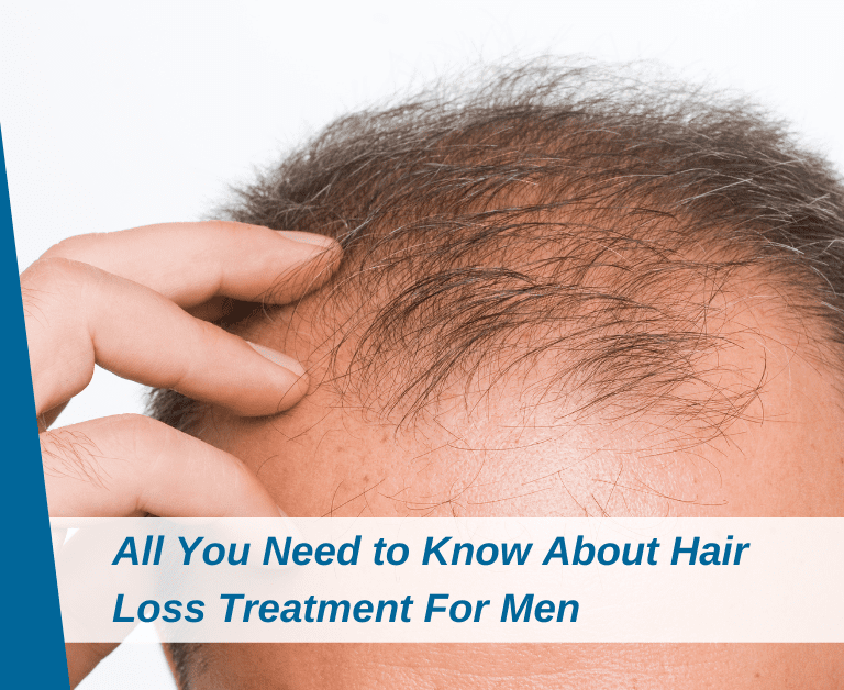 All You Need to Know About Hair Loss Treatment For Men