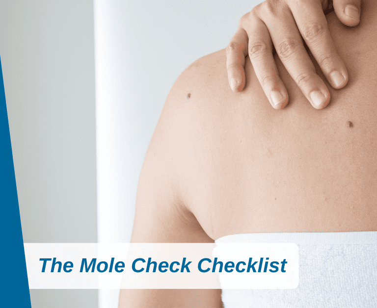 The Mole Check Checklist